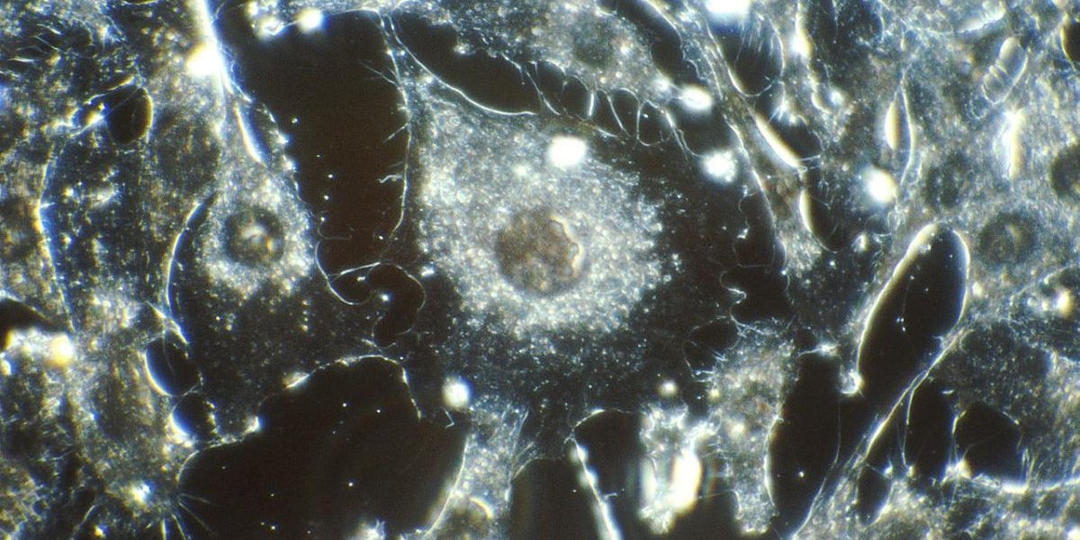 Российские ученые создали светящиеся препараты против рака