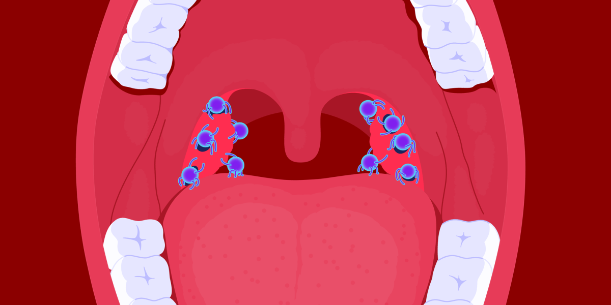 Три шага к диагнозу: как отличить ангину от обычной боли в горле за считанные секунды Три шага к диагнозу: как отличить ангину от обычной боли в горле за считанные секунды