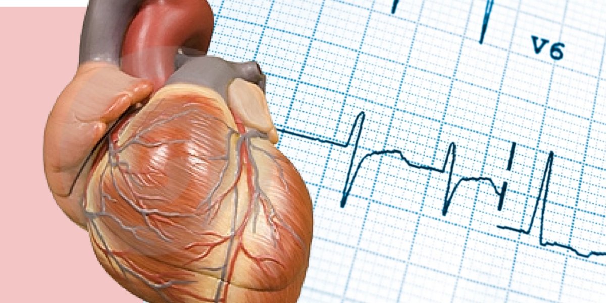 Тревожные сигналы сердца: как распознать приближающийся инфаркт