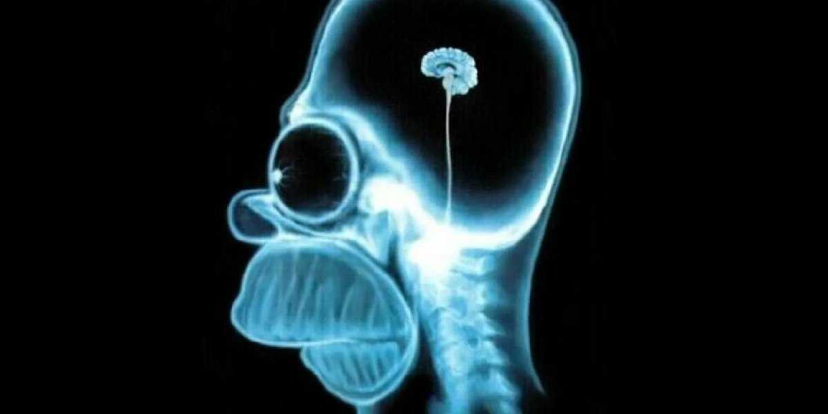 Тихий враг мозга: как лишний вес незаметно разрушает вашу память и интеллект